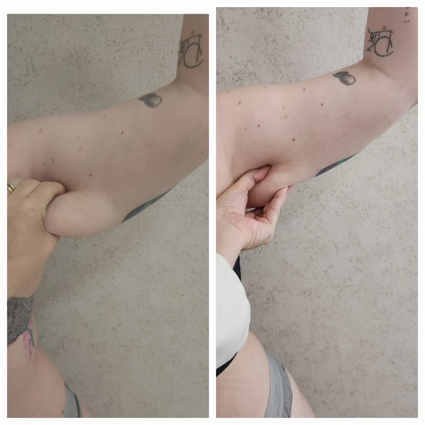 Bioestimulador corporal funciona?