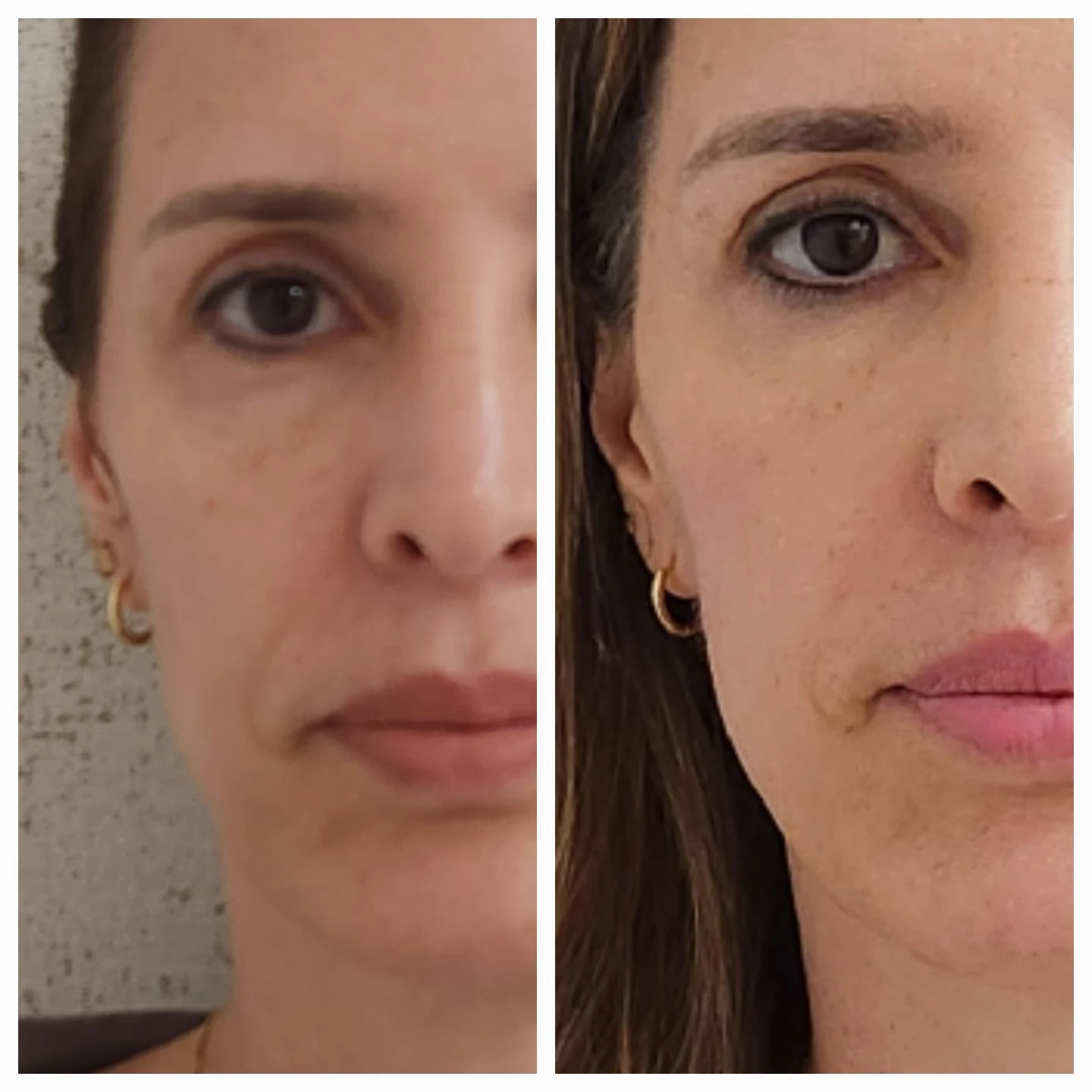 Comparação de atendimento facial — detalhe do rosto